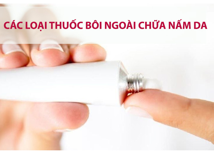 Tổng hợp các loại thuốc bôi ngoài chữa nấm da bạn nên tham khảo