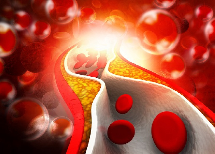Các thuốc điều trị rối loạn Lipid máu