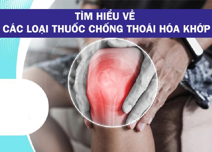 Tìm hiểu về các loại thuốc chống thoái hóa khớp phổ biến