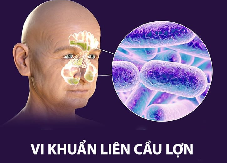 Liên cầu lợn là gì? Thời gian ủ bệnh bao lâu?