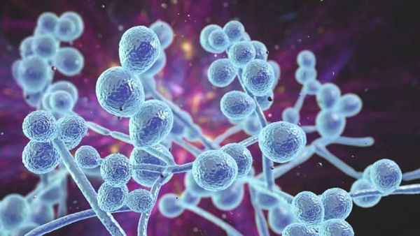 Nấm âm đạo candida, nguyên nhân, triệu chứng