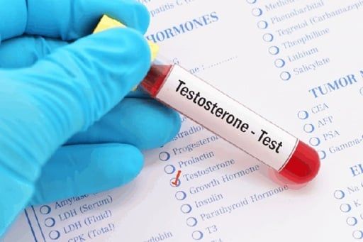 Nồng độ testosterone thấp
