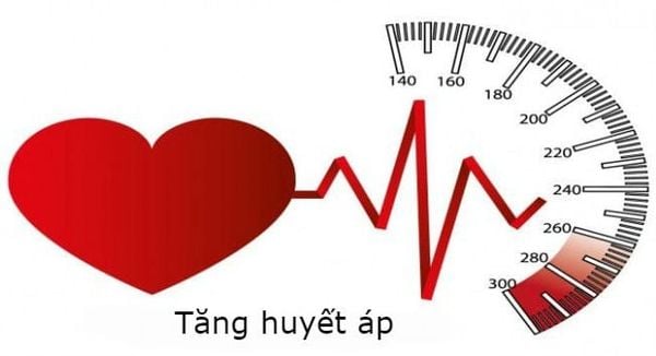 Tăng huyết áp nguy cơ đột quỵ
