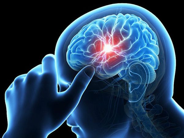 Các loại thuốc phòng chống tai biến mạch máu não