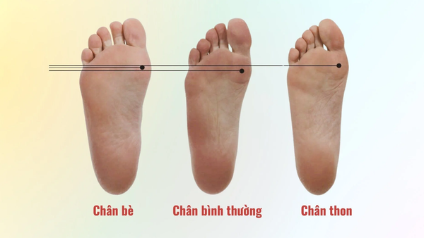 DÁNG CHÂN BÈ PHÙ HỢP VỚI DÁNG GIÀY NÀO?