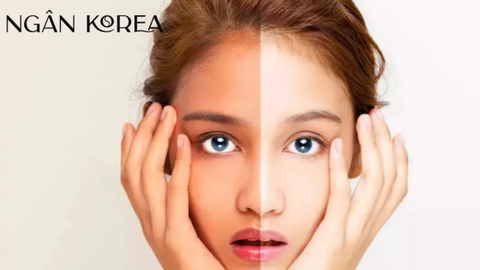 Glutathione có ăn nắng không? Cách bảo vệ da đúng cách khi sử dụng Glutathione