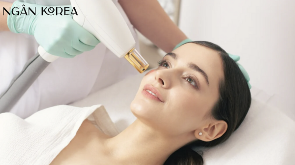 bắn laser trị nám