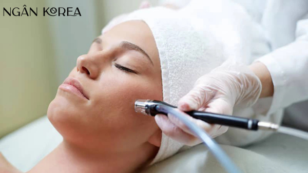 bắn laser trị nám