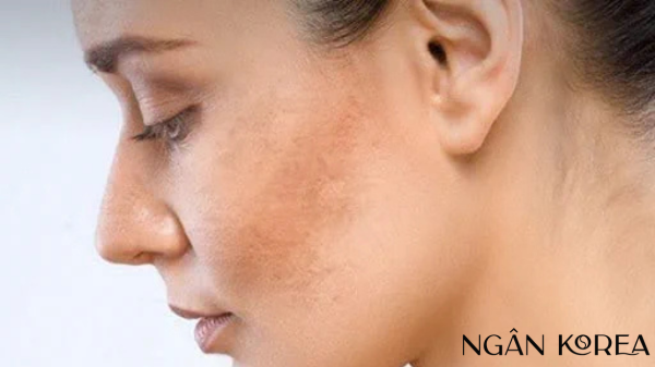 nám nội tiết