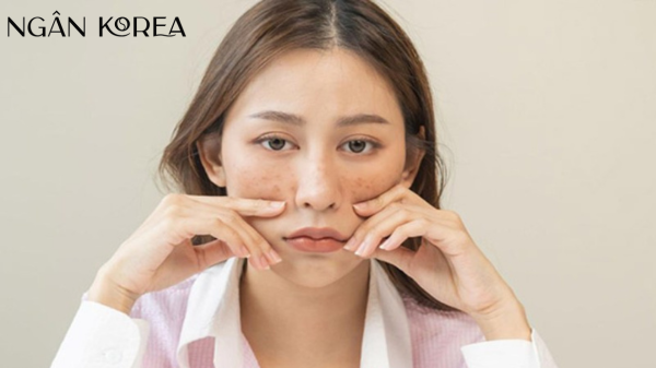 Kem chống lão hóa u40
