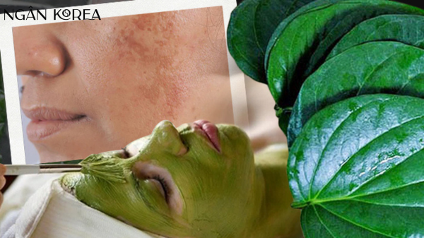 trị nám bằng lá trầu không
