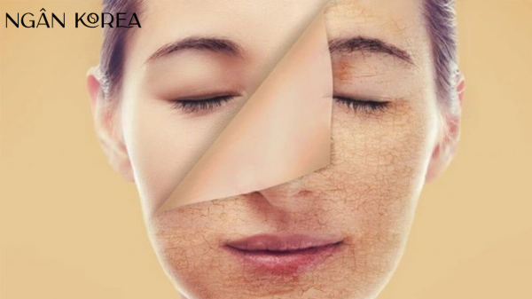 phục hồi làn da bị lão hóa