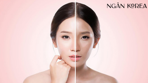 18 tuổi có nên chống lão hóa