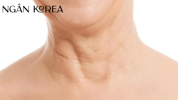 Lão hoá da vùng cổ
