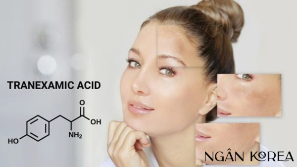 tranexamic acid kết hợp với azelaic acid