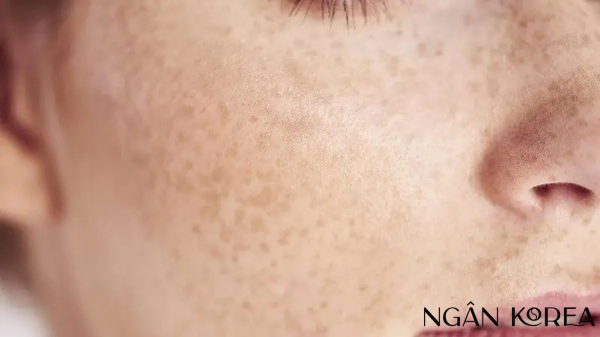 nám nội tiết