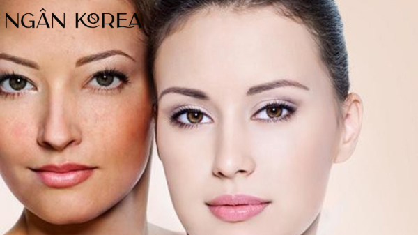 Glutathione có ăn nắng không?