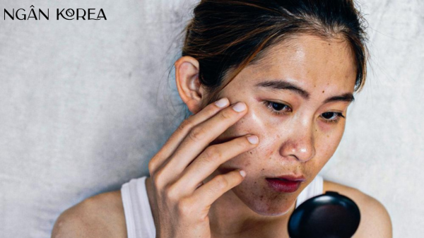 Kem trị nám cho tuổi 40