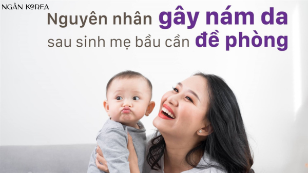 nám da sau sinh