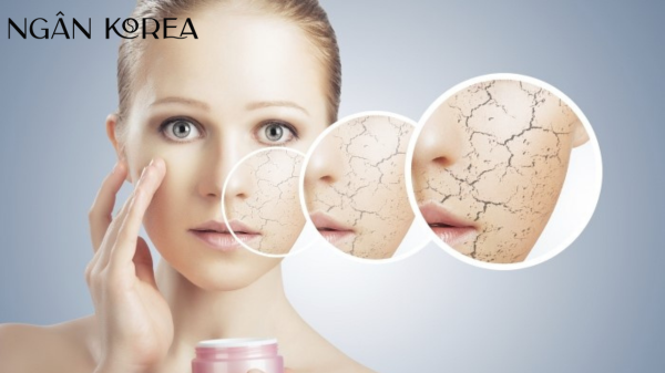 Niacinamide có bắt nắng không