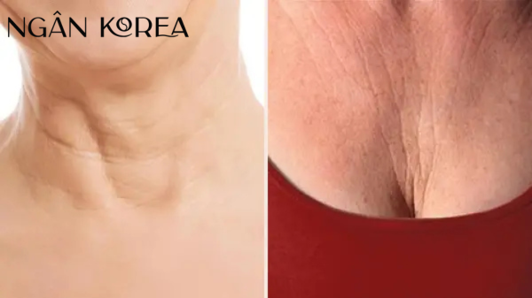 Lão hoá da vùng cổ