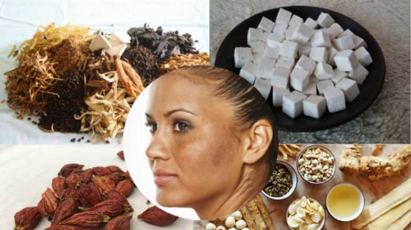 trị nám bằng thuốc Đông y