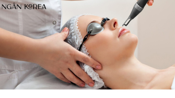 bắn laser trị nám