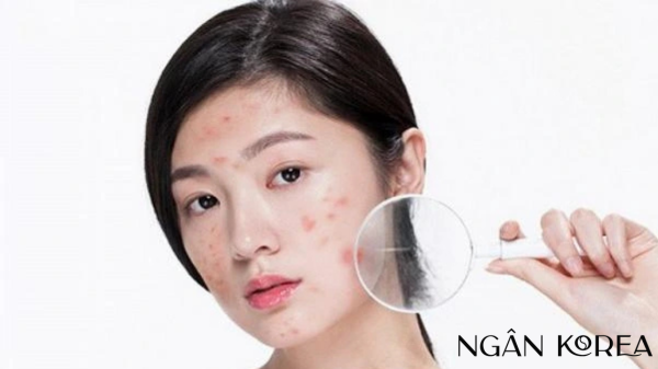 7 bước chăm sóc da cơ bản