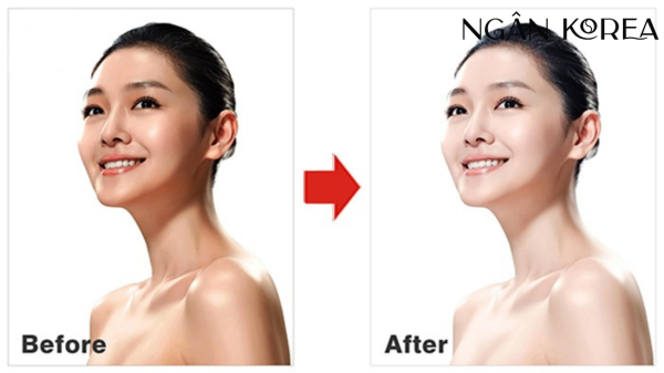 Glutathione và Collagen