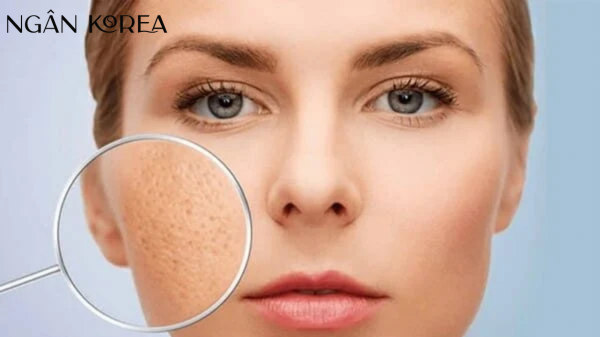 Niacinamide phù hợp với da nào