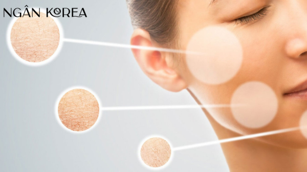 Kem chống lão hóa u40