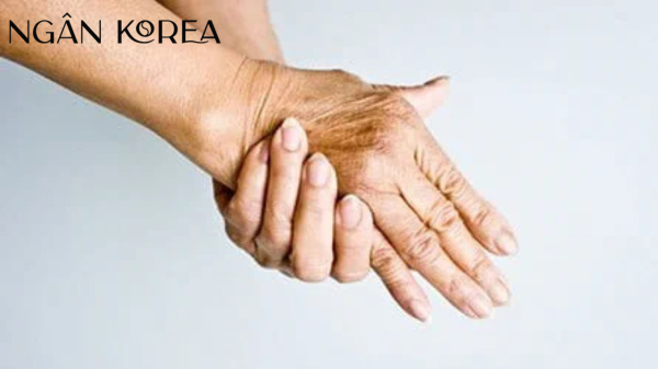 Dấu hiệu lão hóa da tay