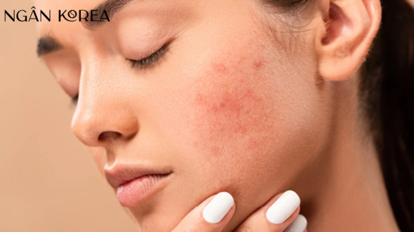 phục hồi làn da bị lão hóa