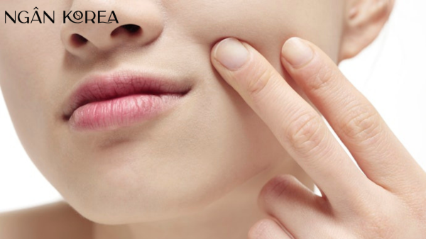 Niacinamide phù hợp với da nào