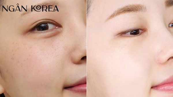 Glutathione có ăn nắng không?