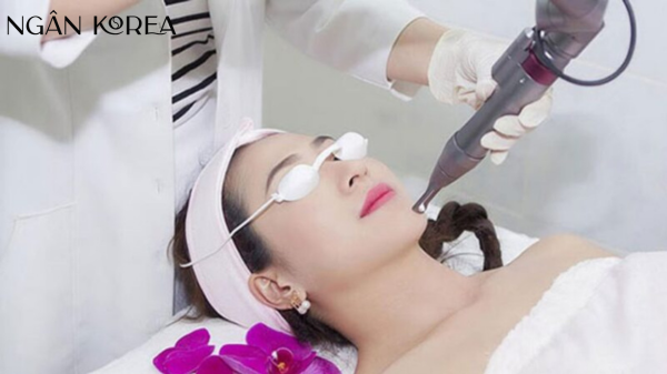 bắn laser trị nám