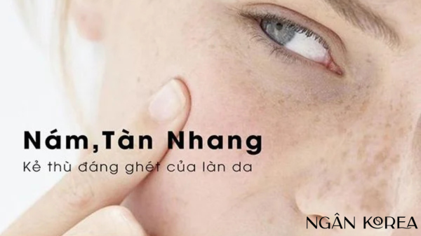 Nám tàn nhang