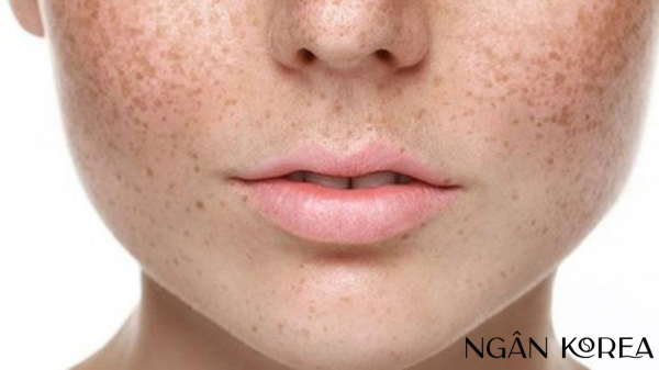 nám nội tiết