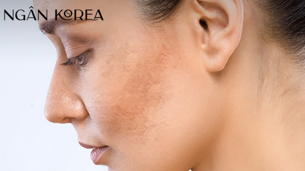 Glutathione có ăn nắng không?
