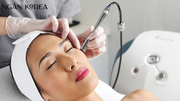 bắn laser trị nám