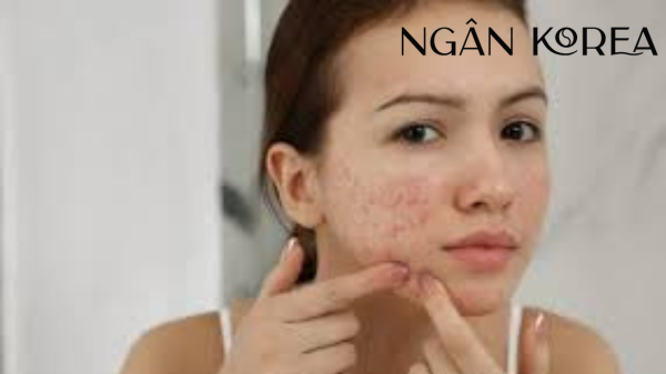 tranexamic acid dùng chung với retinol