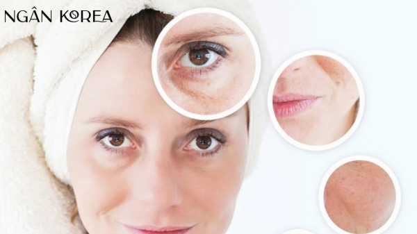 Kem chống lão hóa cho tuổi 30