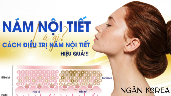 nám nội tiết