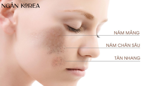 hình ảnh nám mảng