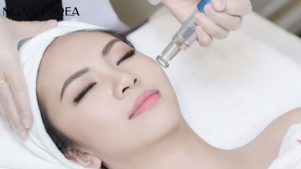 bắn laser trị nám