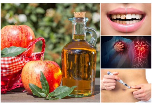 Giấm táo cùng 9 tác dụng thần kỳ cho sức khỏe và sắc đẹp