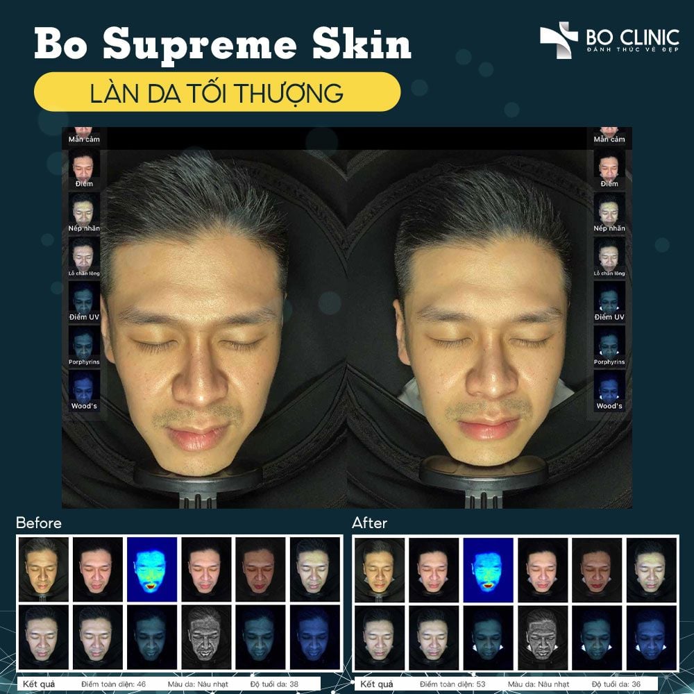 Supreme Skin - Không Hiệu Quả, Không Phải Trả Tiền