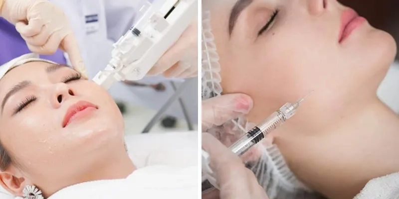 Tiêm Meso bằng máy và bằng tay phương pháp nào hiệu quả hơn?