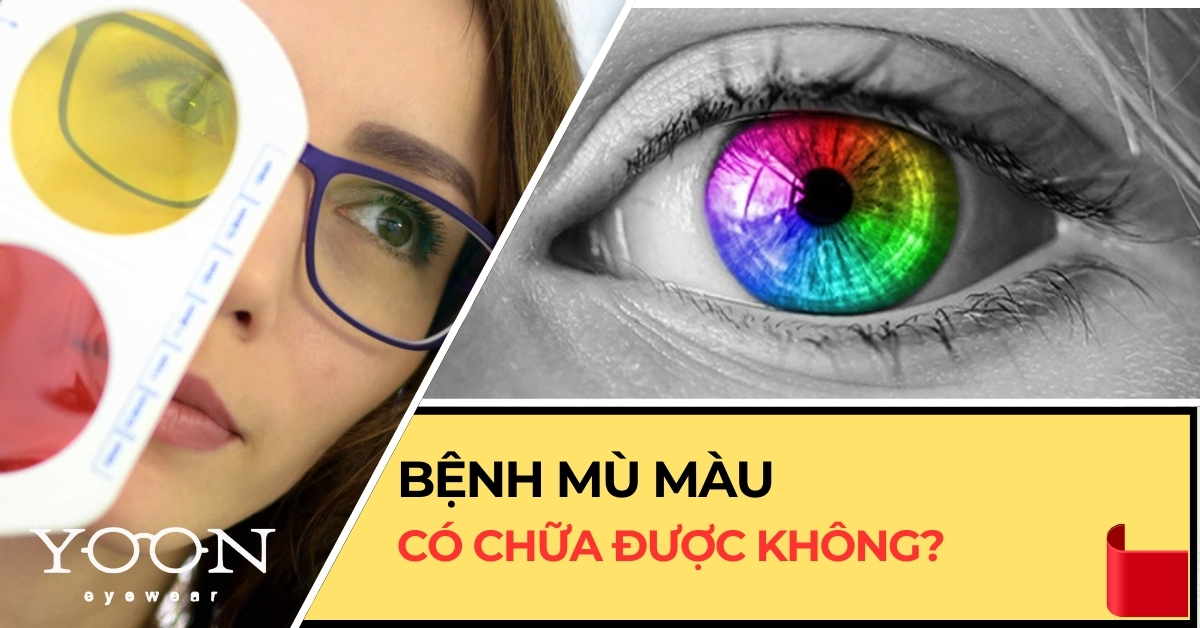 Bệnh Mù Màu - Nguyên Nhân Và Cách Phòng Bệnh