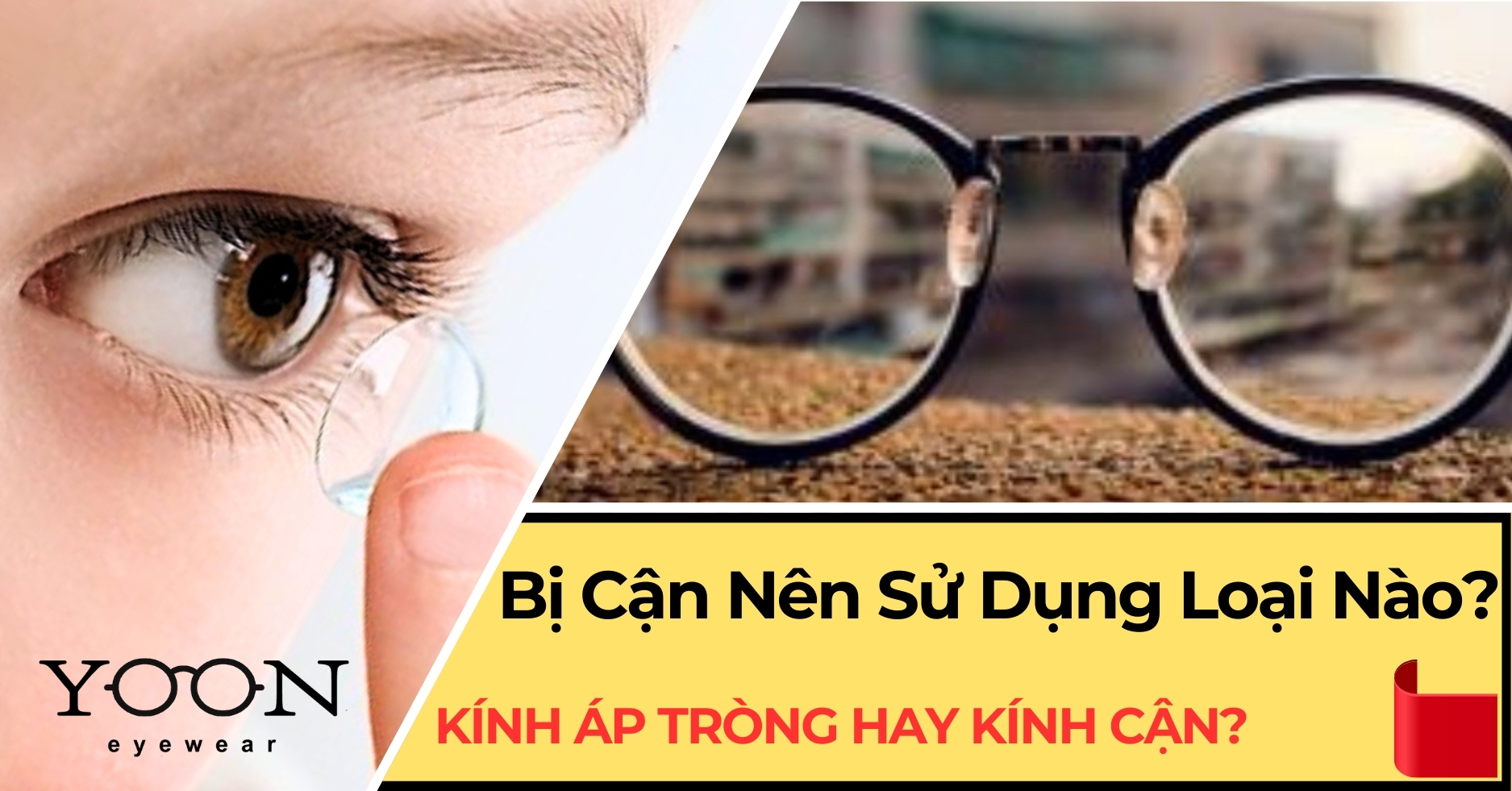 Bị Cận Nên Sử Dụng Kính Áp Tròng Hay Kính Cận